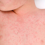 Održana skupština Organizacije slijepih iz Prnjavora: Izražen interes za jednostavniju nabavku tehničkih pomagala